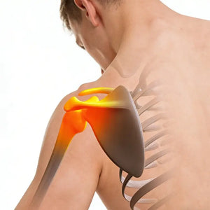 Rotator Cuff Injury