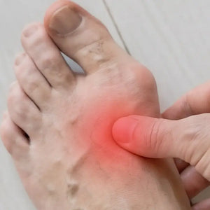Bunion Relief