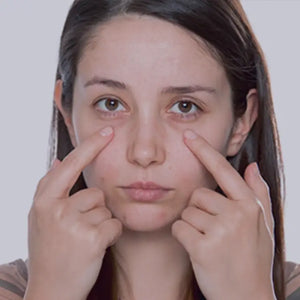 Dark Circles & Eye Bags